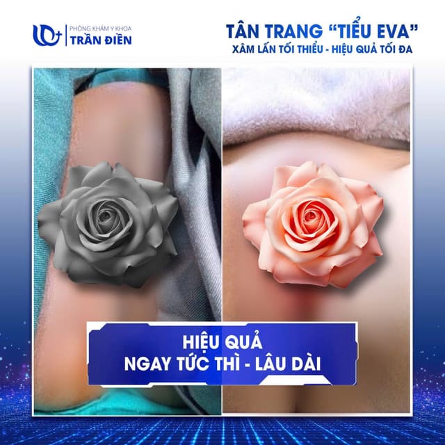Chị K. Hà - 32 tuổi