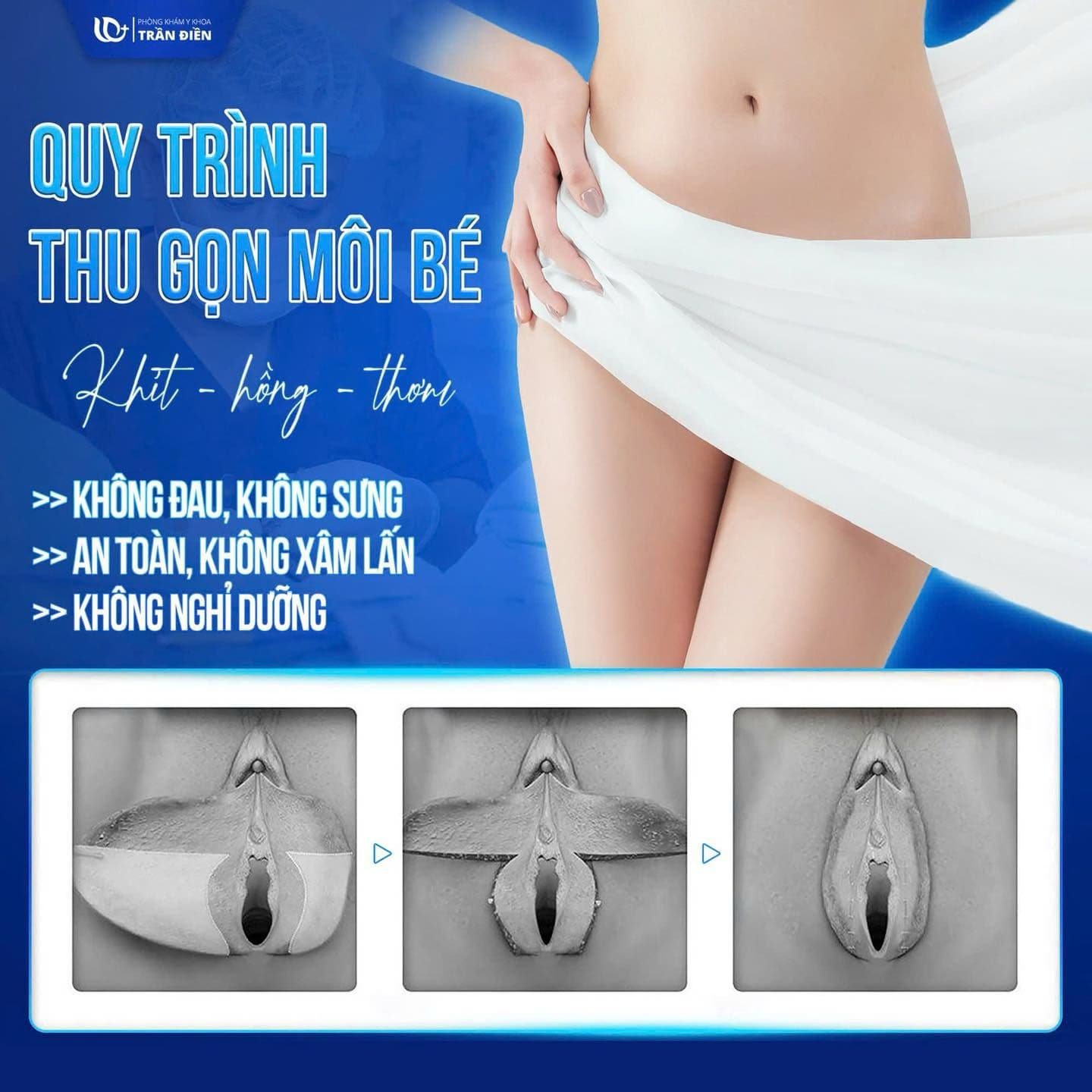 Quy trình chăm sóc sau phẫu thuật thẩm mỹ vùng kín